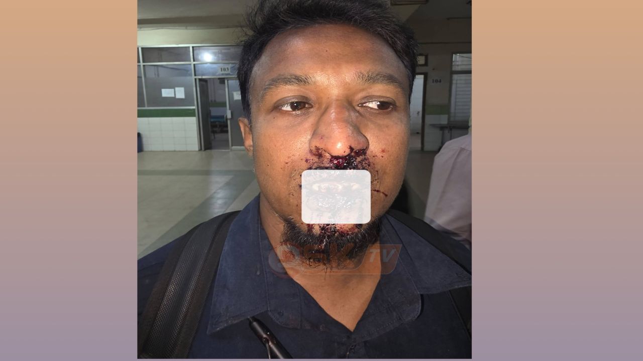 যাত্রাবাড়ীতে সাংবাদিকের ওপর হাম'লার মর্মান্তিক পরিণতি ছেলের র'ক্তাক্ত মুখ দেখে মায়ের মৃ'ত্যু