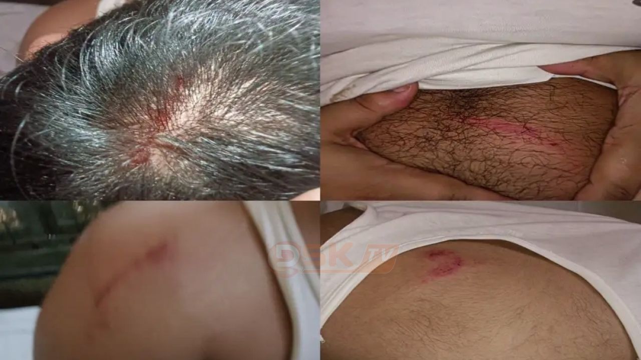 কুড়িগ্রামে ছাত্রশিবিরের পলিটেকনিক সভাপতির ওপর ছাত্রদলের হামলার 