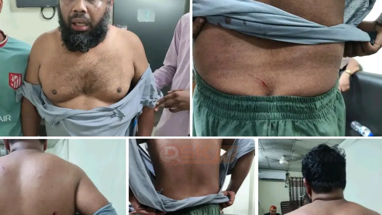 জামায়াত কর্মী মামুনুল ইসলামের উপর বিএনপি সন্ত্রাসী কর্তৃক সশস্ত্র হামলা ও দোকান দখল।