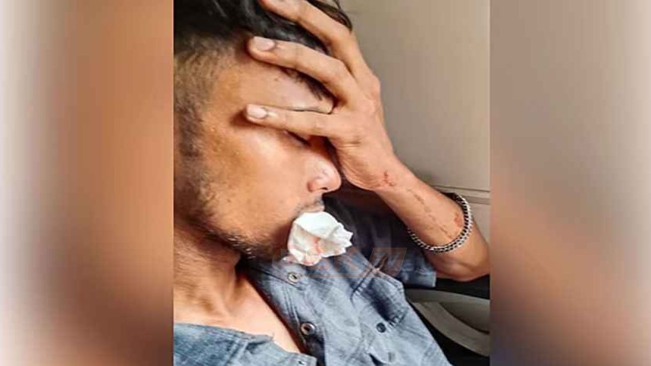 কক্সবাজার এক্সপ্রেসে পাথর নিক্ষেপ: চার দাঁত ভাঙাসহ আ'হত ২