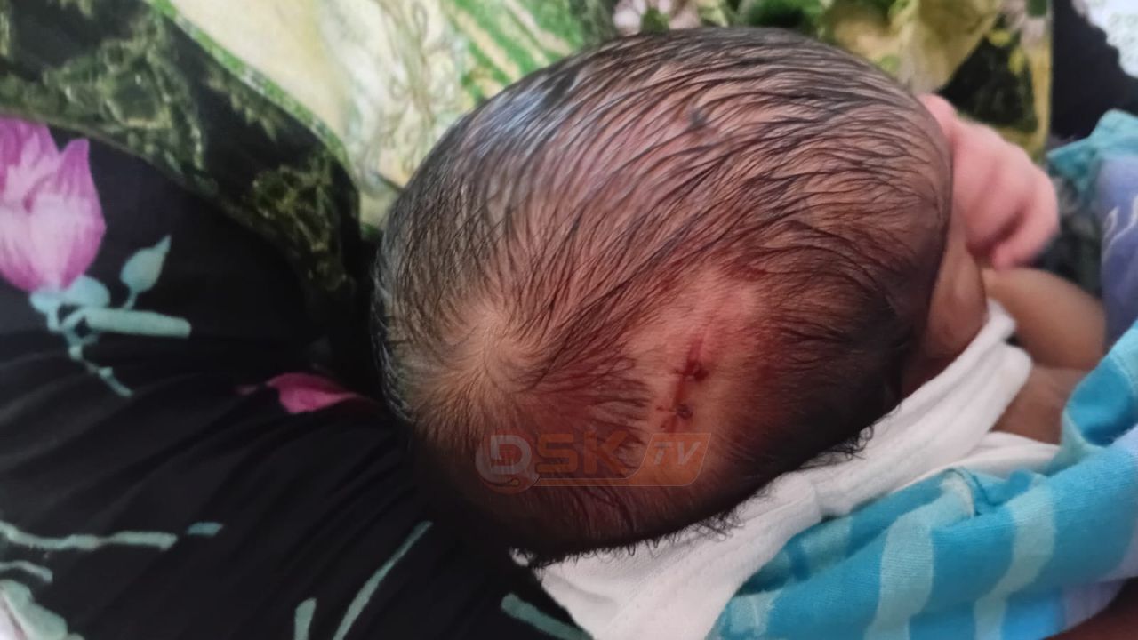 ভূরুঙ্গামারীতে সীমান্ত ক্লিনিকে সিজারকালে নবজাতকের মাথা কাটা পড়ার ঘটনা ঘটেছে: থানায় অভিযোগ দায়ের।