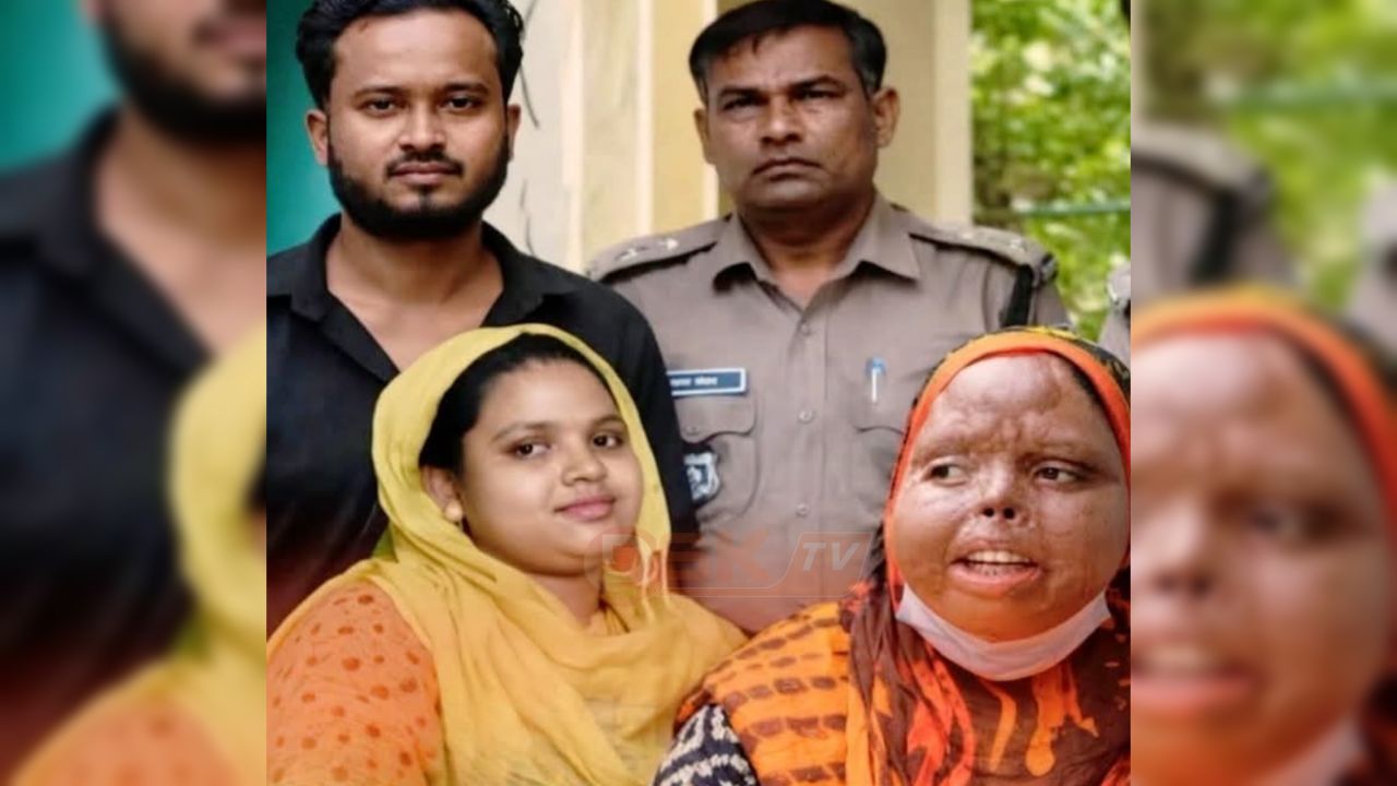 গরম ডাল ছুড়ে স্ত্রীর মুখ ঝল'সে দেওয়ার অভিযোগ, তালাকের পর স্বামী গ্রেফতার